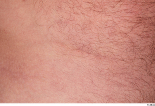 Neeo hairy nude scar skin 0001.jpg